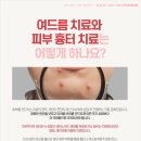 가네샤의원 네이버블로그