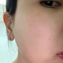코뎀 | 스피큘DCAV리프팅크림 더메디코뎀 사용후기🖤