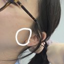 황금의원 | 이하선종양 발견부터 이하선종양 수술까지, 땡큐서울의원(1)