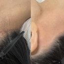 헤어아르니 이미지