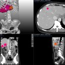 엠에스병원 이미지