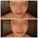 [분당/수내역] 분당피부관리 더조각 얼굴윤곽관리 :: 내안에힐링스파 이용후기