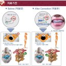턱관절을 이용한 질병치료 이미지