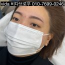 비로우