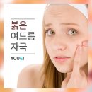 유앤아이스킨케어 이미지