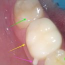 이바른치과기공소 이미지