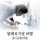 정경한의원 | 알레르기 비염, 그냥 “코 알레르기”가 아닙니다— 35세 여성 환자분 이야기로 풀어보는 알레르기 비염...