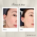 【구미】옥계 피부관리 진정 케어 +이어 테라피 찐 감동_730스킨