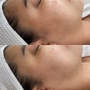 트로시에스테틱 | 별내동 피부관리 트로시에스테틱 윤곽리프팅케어 후기