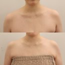 (주)신광에너지 | 청라 루원시티피부관리 바디관리 에너지테라피 진짜 잘하는 금손테라피 찐 후기! 결혼준비하시는 분들...