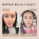NO.1 자동차피부과 | 홍대피부과 제네시스레이저 gla 재생토닝 홍조관리 후기