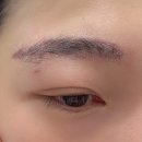 뉴(NEW) 남대구약국 | 대구 수성구 만촌동 &#39;비플러스뷰티&#39; 1차 눈썹문신 붉은 잔흔 제거 상태 내돈내산 후기