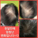 까망머리 이미지