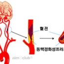 대뇌(Cerebrum) 이미지
