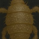 🐞왜 머릿니는 대머리 싫어할까? (Why do head lice avoid bald heads?)