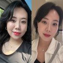 타임락뷰티 - 수성구 | 튠페이스 유지기간 튠라이너 3회차 전후 타임락튠 효과 후기