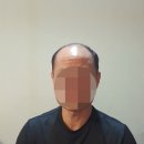 전주동안가발 이미지
