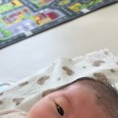 신생아 딸기혈관종 이석종 피부과 방문후기 주차 예약