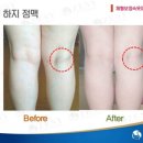 제니패션기능성보정속옷 이미지