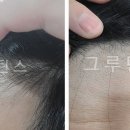 비포애프터 - 고양시 일산서구 탄중로 106 | 비포애프터