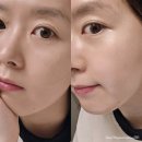 에스테틱브랜드 천연화장품 카이피 수부지 스킨케어 솔직후기