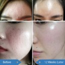 루디아피부비만관리