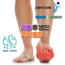 튼튼연합외과의원 네이버블로그