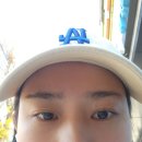 대연당한의원 | 부산 한의원에서 편평사마귀 제거 후기, 가격 내돈내산