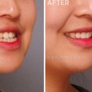 압구정연치과의원 이미지