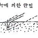 단순보이앤씨