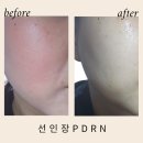 선인장 | 무신사 선인장PDRN 앰플 후기 피부진정 수분세럼 추천 루틴