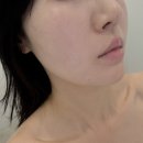 라마다&스킨