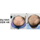 레드우드하라힐즈 네이버블로그