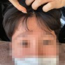 숲칼프인천만수점 | 간석동 두피관리 숲칼프 인천만수점 개운하고 상쾌