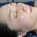 전의우체국 | 알테온 내돈내산 솔직 후기, 르주비아 에스테틱 포항 피부 관리