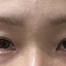 아르필의원 네이버블로그