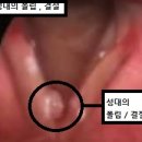 성대한의원 네이버블로그