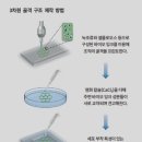 동아산소 이미지