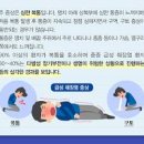 췌장염 증상 정리 급성 만성 이미지