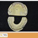 아이디치과기공소 이미지