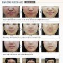 강남아토피 프리허그한의원의 수능이벤트