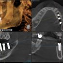 서현치과기공소 이미지