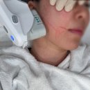 프라임한방병원 | 선정릉 피부과 내돈내산 울쎄라피 프라임 리프팅 솔직후기