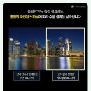렌즈미주안점 | 렌즈삽입술 후기 영향을 받게 되는 부분
