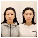 미본 | 강남 윤곽관리, 체형교정 “미본” 관리 후기