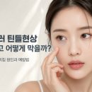 고운하늘의원 | 인천 눈밑필러 틴들현상 생기지 않게 하려면?