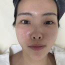 힐뷰티 | 창원 피부관리 수앤유뷰티 재방문 내돈내산 솔직후기 힐로리아 스킨부스터 관리 중요한날 관리