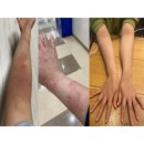영화유지팩(영화UG팩) | 시너지 메가원팩 다이어트에 간헐적단식까지 진행한 솔직후기