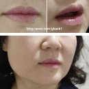 범어3동 제1경로당 | 대구 입술반영구 리터치 후기, 대구눈썹문신 김홍뷰티