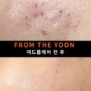 더윤피부전문샵